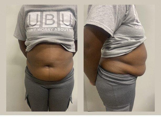 U.B.U Body Sculpting & Medspa