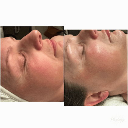 Esthetics by Priscilla - Facials