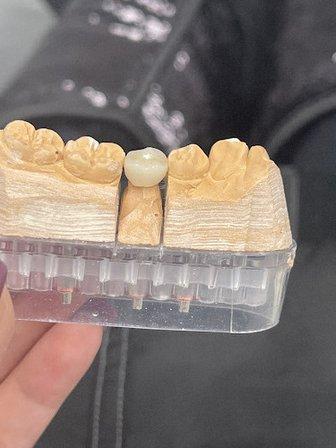 Holmes Dental Center -Dr. Phil Morales DDS