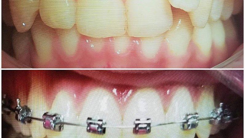 Texas Smiles dental center