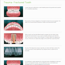 Emergency Dentist San Antonio