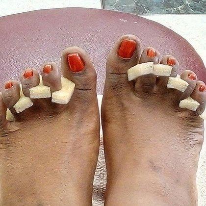 V-N Nail