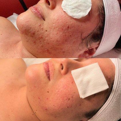 Skinfinite
