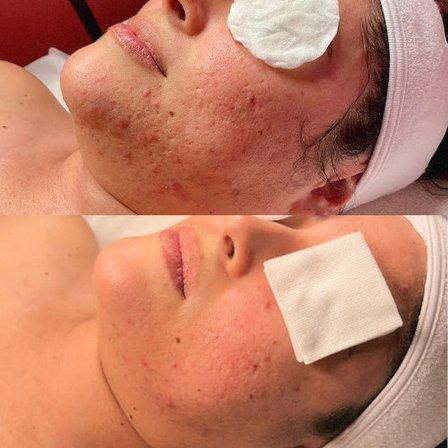 Skinfinite