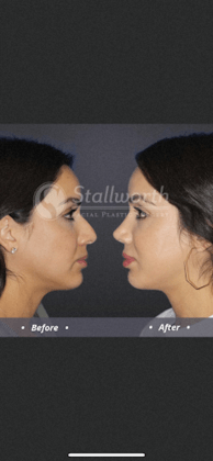 Texas Plastic Surgery