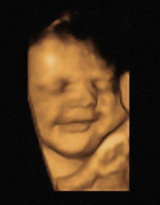 Babyview Ultrasounds