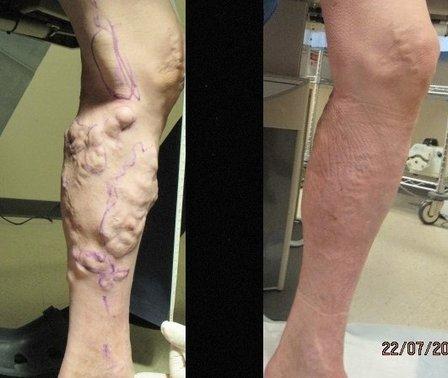 San Antonio Vein Clinic