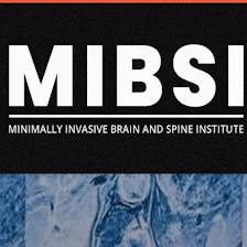 Yan Michael Li MD PhD FAANS Minimally Invasive Brain and Spine Institute San Antonio/Austin Office