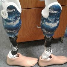 Prosthetic Technology Center