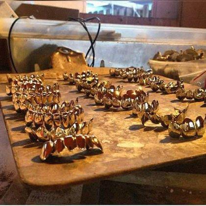 Gold Teeth Of San Antonio..